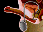 11111111.gif